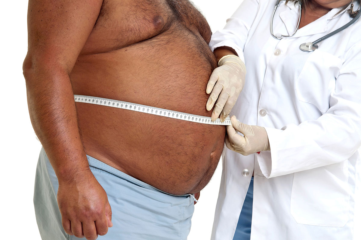 Doctor Measuring the Belly of an Obese and Overweight Male