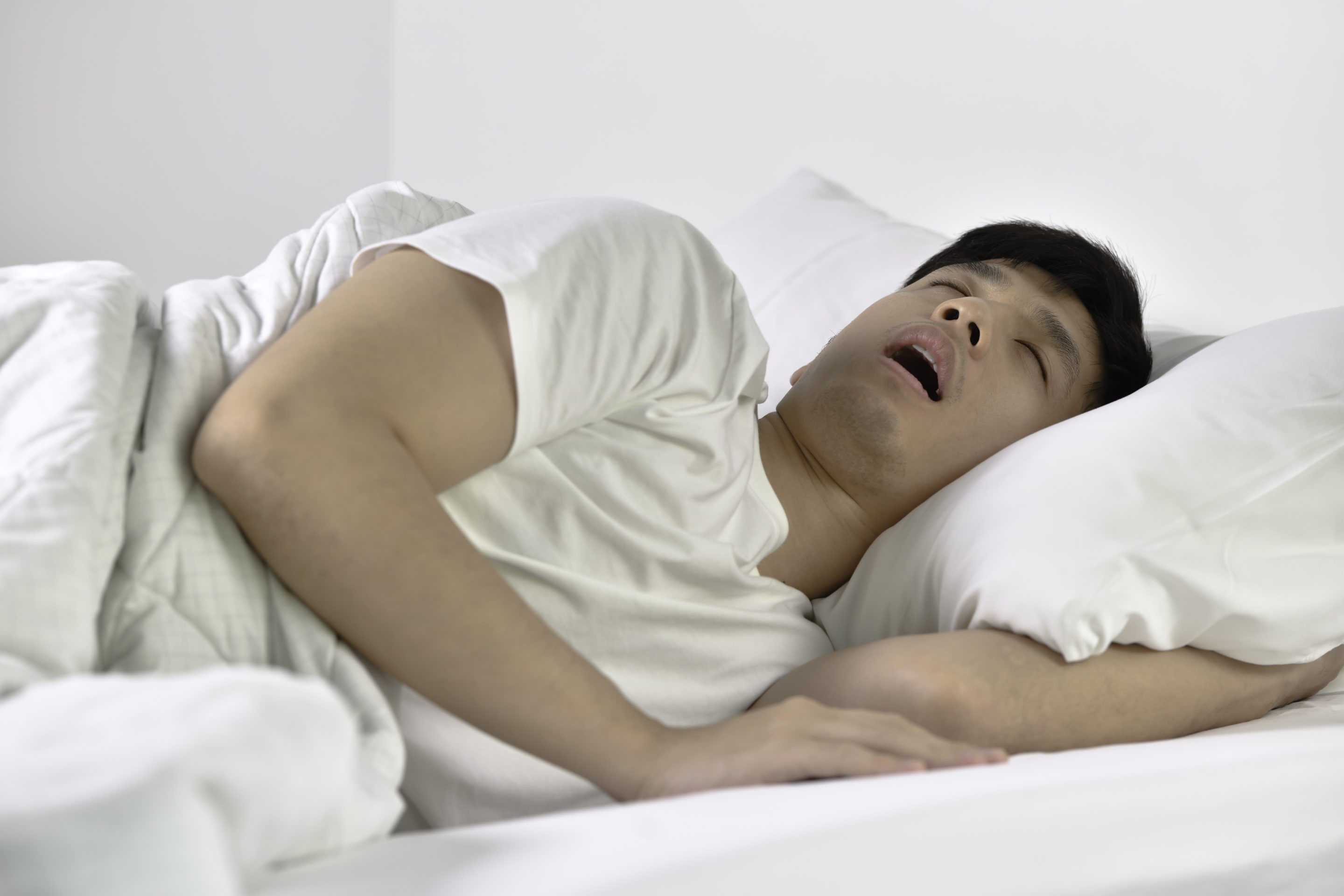 Young man snoring loudly while asleep in bed.